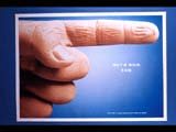 Finger