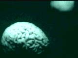 Brain