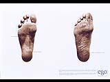 Feet